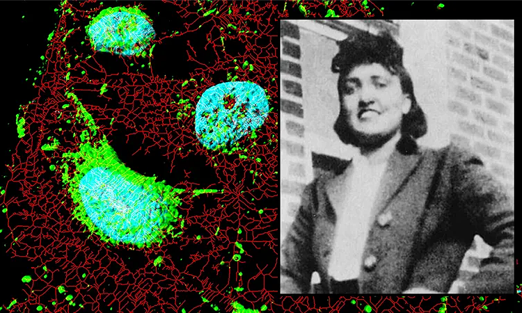 Gia đình người có 'tế bào bất tử' đạt thỏa thuận với công ty dược