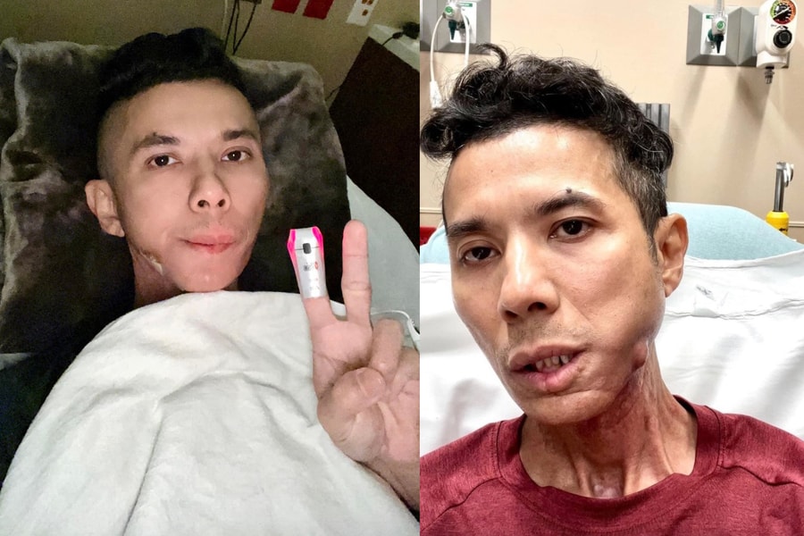 3 năm chiến đấu với bạo bệnh của Kasim Hoàng Vũ trước khi qua đời