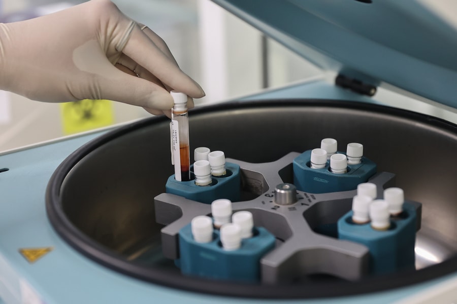 Hỏng 'chuyện ấy' vì béo bụng, mỡ nội tạng