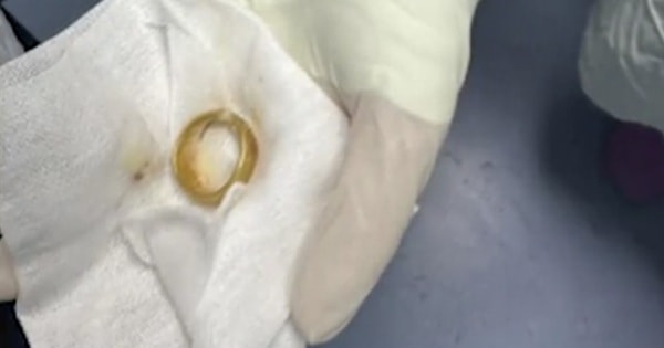 Khám cho cụ ông, bác sĩ phát hiện ra "bí mật" bất ngờ