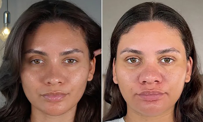 Cú sốc 'mặt phá nét' của nữ Influencer trong lần đầu mang thai