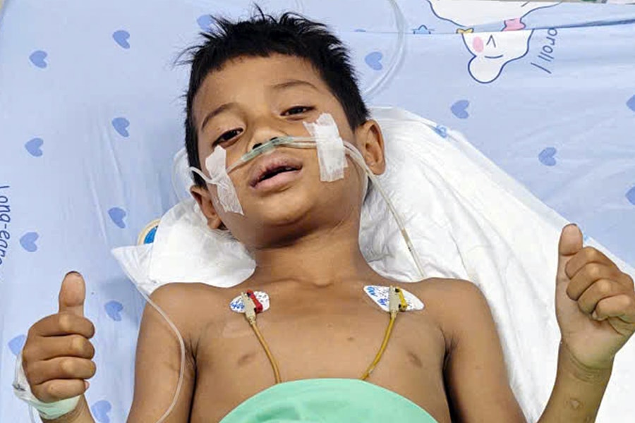 3 trẻ ngộ độc botulinum cai máy thở sau khi dùng thuốc giải
