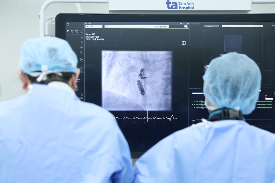 Cấy máy tạo nhịp không dây cho cụ ông phòng nguy cơ đột tử