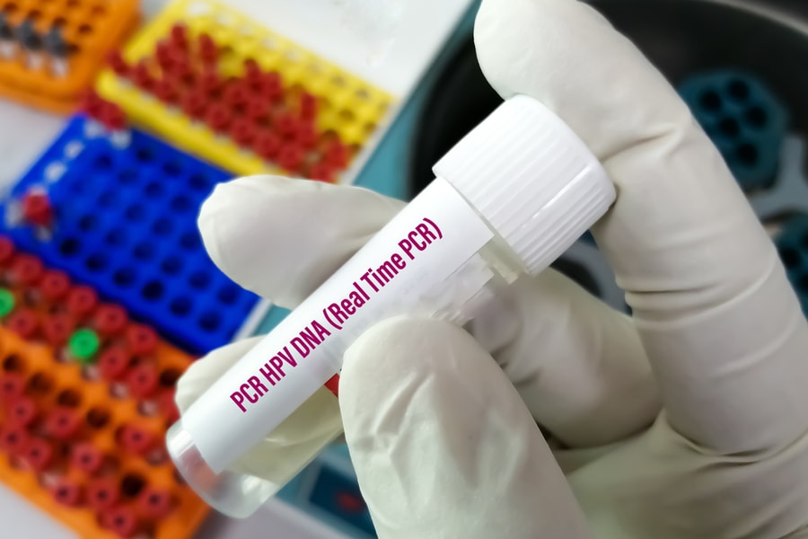 Nam giới hay nữ giới khó đào thải virus HPV hơn?