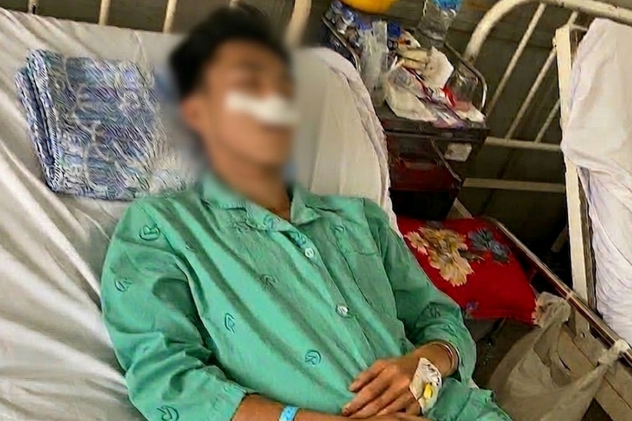 Nam sinh lớp 11 bị bạn đánh gãy xương mũi