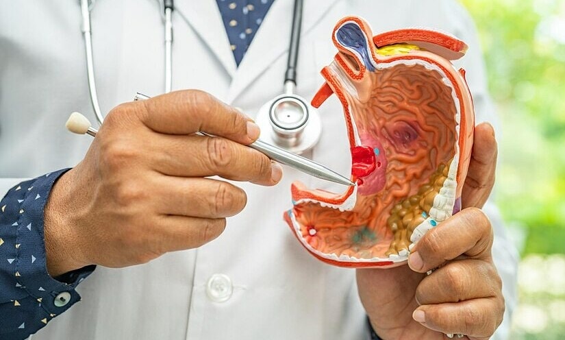 Cô gái phát hiện ung thư dạ dày di căn từ khối u ở cổ