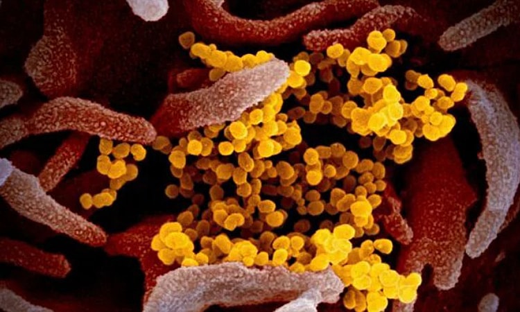 Biến thể Covid 'Ve sầu' siêu đột biến lây lan tại Mỹ