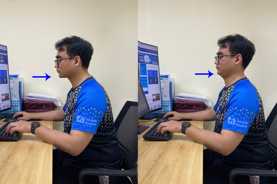 Ba bài tập giảm mỏi cổ vai gáy tại bàn cho dân văn phòng