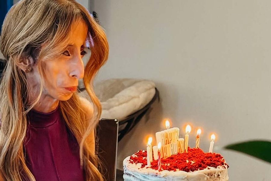 Sự lột xác của 'người phụ nữ xấu nhất thế giới'