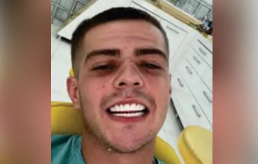 Kẻ buôn ma túy bị bắt vì gửi ảnh 'khoe răng' cho bạn