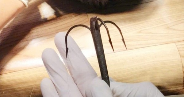 Thiếu niên gặp sự cố hi hữu khi đi câu cá, phải nhập viện xử lý gấp