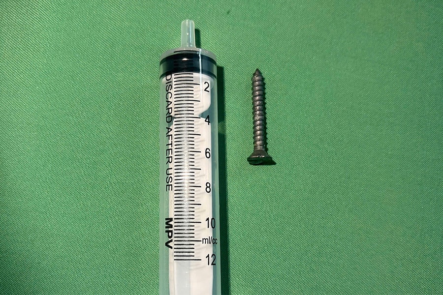 Bé gái nuốt đinh vít dài 2,5 cm