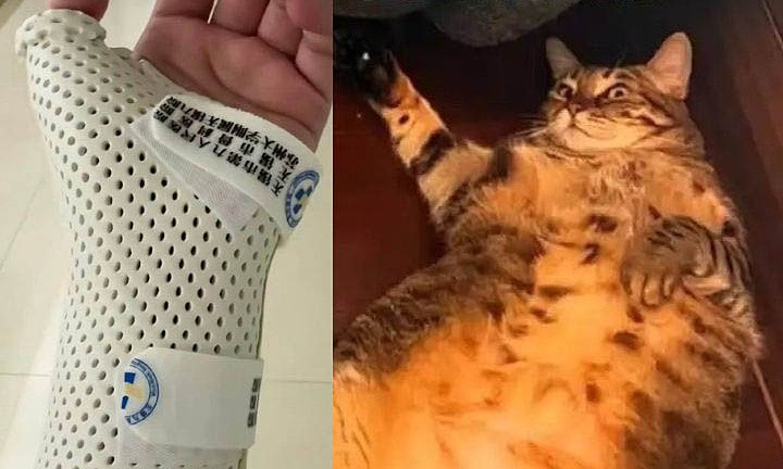 Bị mèo nặng 7,5 kg 'đè' khi ngủ, cô gái gãy xương cổ tay