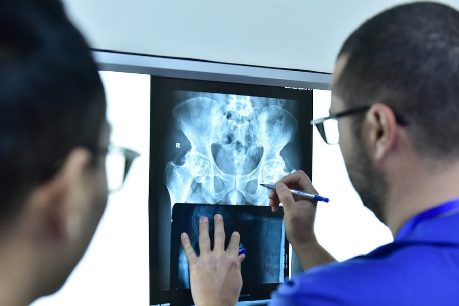 Bác sĩ dự báo ca thay khớp háng tăng trong 10 năm tới