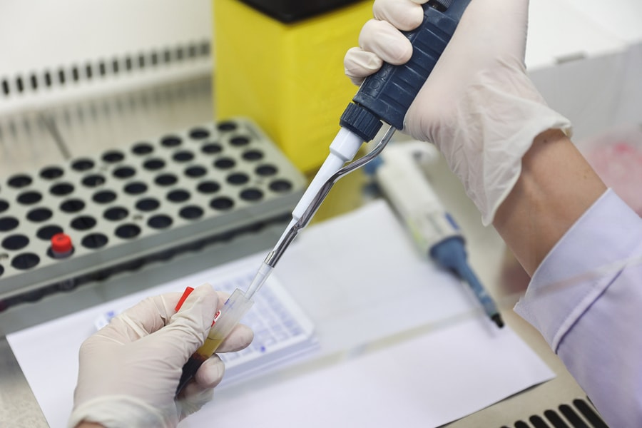 Bé đột ngột co giật, bác sĩ phát hiện viêm cầu thận sau viêm họng